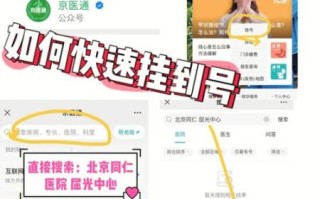 北京同仁眼科医院怎么挂号_北京同仁眼科医院专家号预约攻略 北京同仁眼科医院怎么挂号_北京同仁眼科医院专家号预约攻略