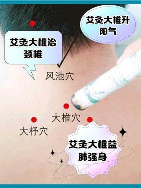 艾灸多久做一次合适_艾灸能天天做吗-第2张图片-俊逸知识馆 艾灸多久做一次合适_艾灸能天天做吗-第2张图片-俊逸知识馆