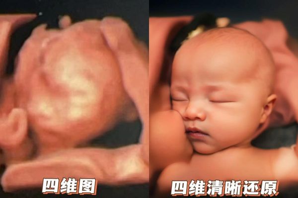 四维图新怎么样_四维图新值得投资吗-第3张图片-俊逸知识馆 四维图新怎么样_四维图新值得投资吗-第3张图片-俊逸知识馆