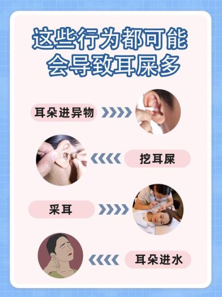 耳屎多了会怎么样_耳屎堵塞耳朵怎么办-第1张图片-俊逸知识馆 耳屎多了会怎么样_耳屎堵塞耳朵怎么办-第1张图片-俊逸知识馆