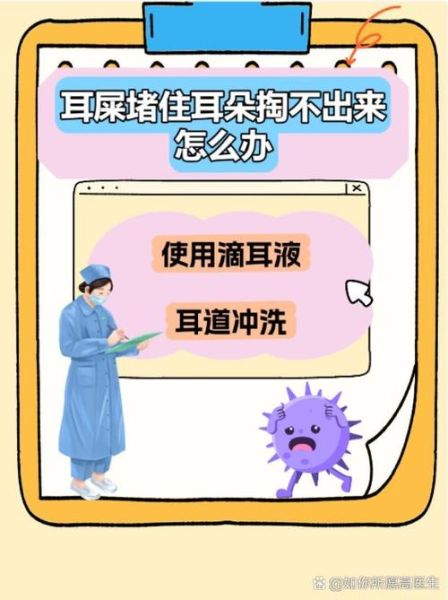 耳屎多了会怎么样_耳屎堵塞耳朵怎么办-第2张图片-俊逸知识馆 耳屎多了会怎么样_耳屎堵塞耳朵怎么办-第2张图片-俊逸知识馆